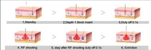 Portable MRF Fractional RF Beauty machine