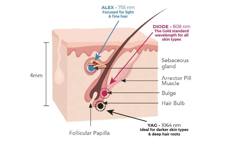 High Power Laser Diode Hair Removal Price