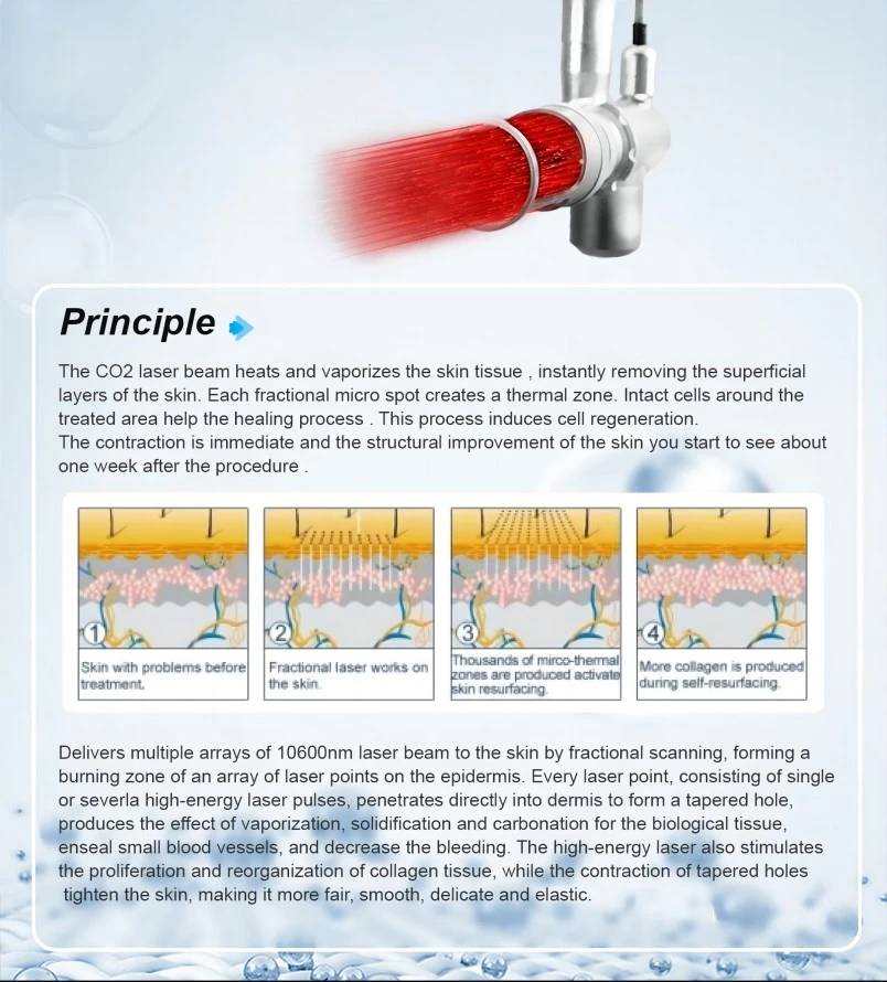 co2 laser skin machine co2 laser skin machine