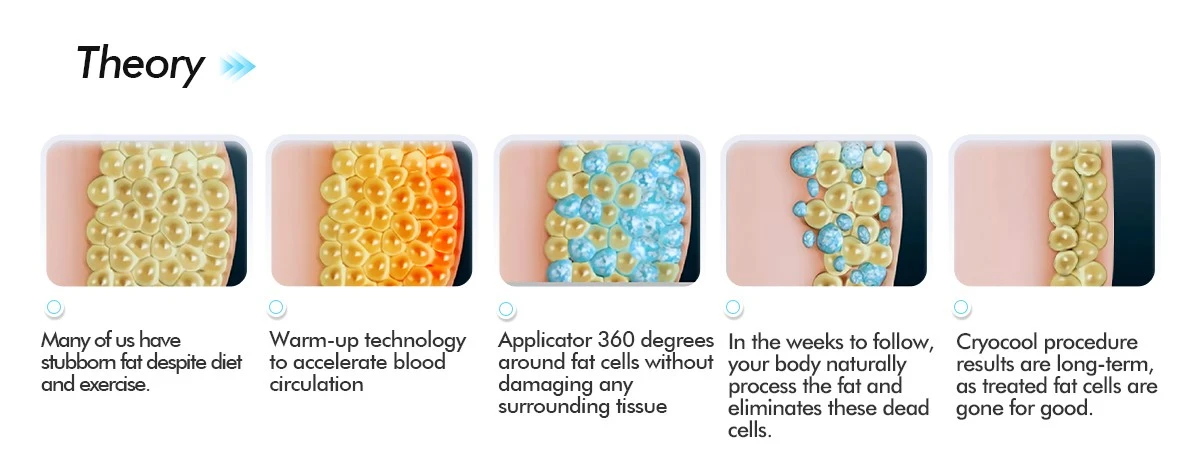 Cryolipolysis Fat Freezing Machine Cryolipolysis Fat Freezing Machine